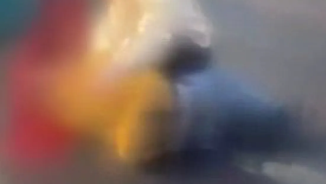 Otomobilin çarptığı 18 yaşındaki genç ağır yaralandı