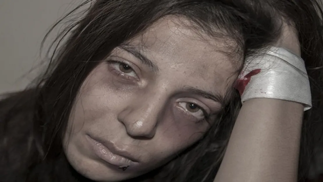 100 kadın fotoğraflarla şiddete hayır dedi