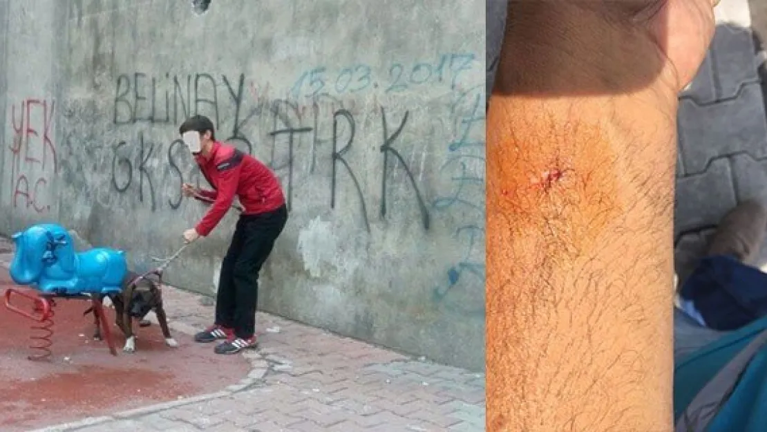 Köpeğin saldırdığı adam kolundan yaralandı