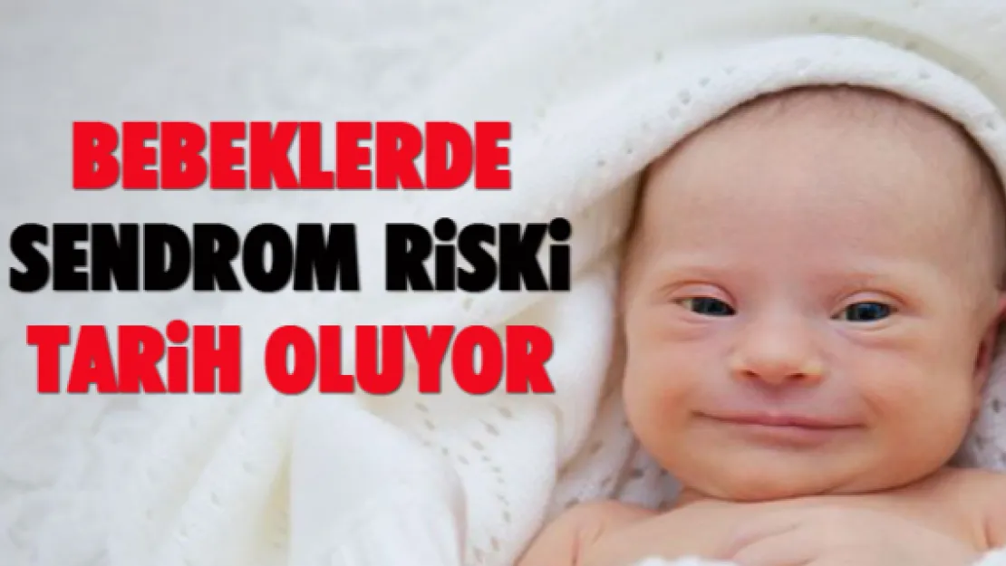 Bebeklerde sendrom riski tarih oluyor