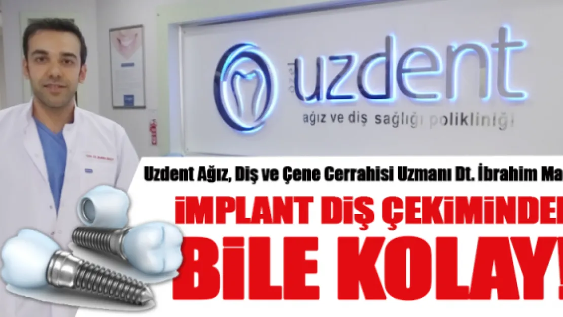 İMPLANT DİŞ ÇEKİMİNDEN BİLE KOLAY!