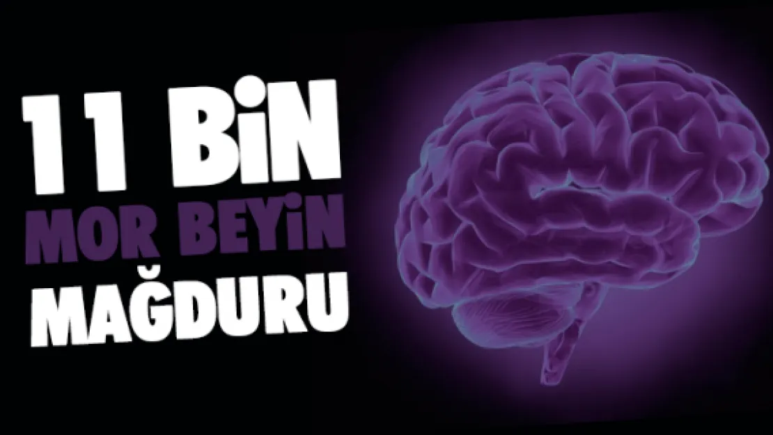 11 bin 'Mor Beyin' mağduru