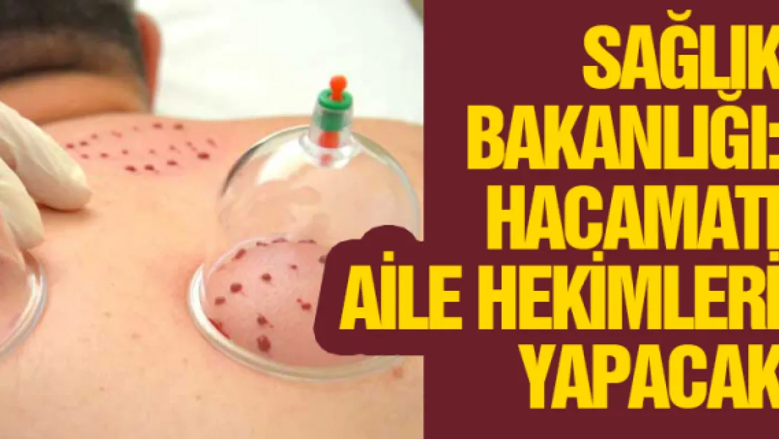 Sağlık Bakanlığı: Hacamatı aile hekimleri yapacak