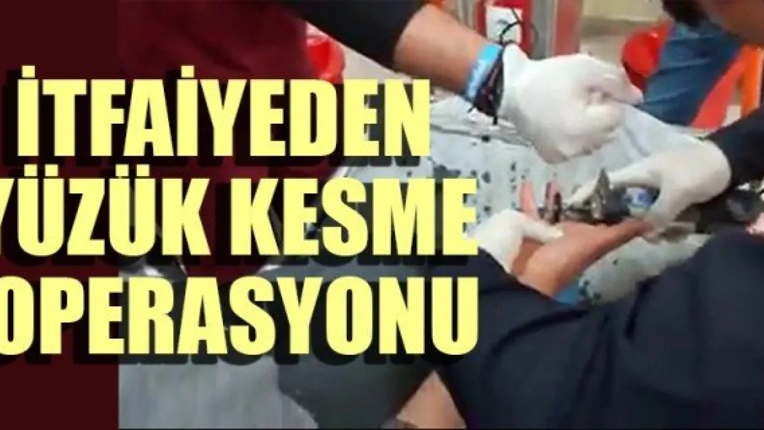 İTFAİYEDEN YÜZÜK KESME OPERASYONU