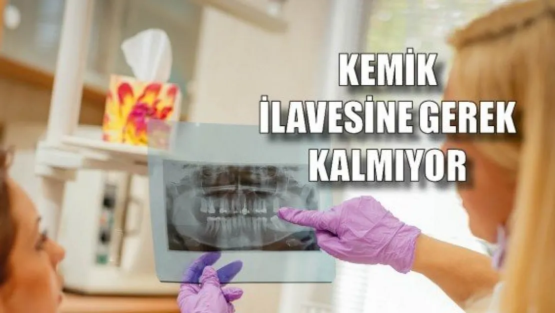 Kemik ilavesine gerek kalmıyor