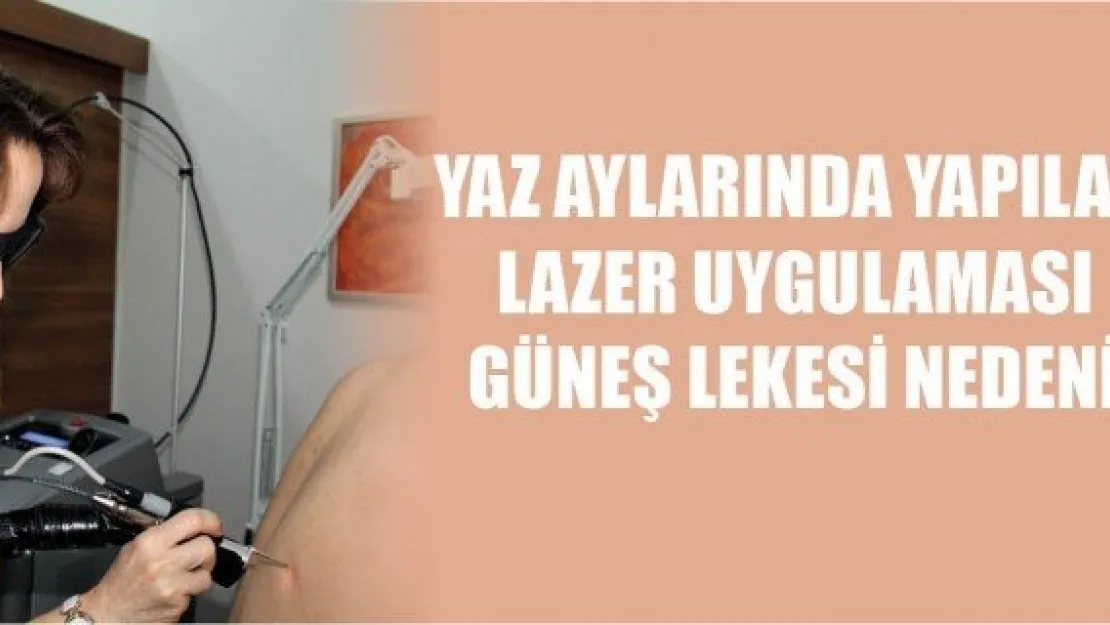 Yaz aylarında yapılan lazer uygulaması güneş lekesi nedeni