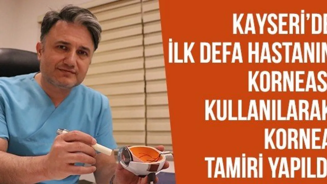 Kayseri'de İlk Defa Hastanın Korneası Kullanılarak Kornea Tamiri Yapıldı