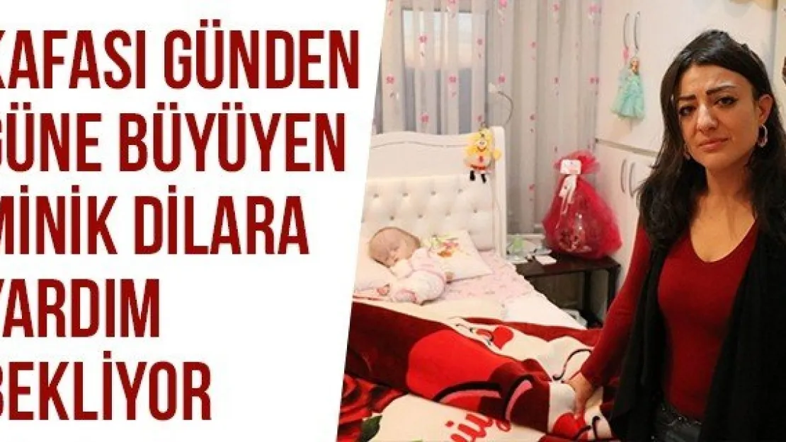 Kafası Günden Güne Büyüyen Minik Dilara Yardım Bekliyor