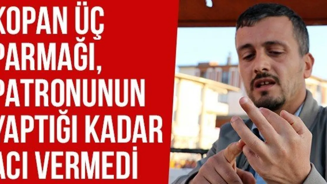 Kopan Üç Parmağı, Patronunun Yaptığı Kadar Acı Vermedi