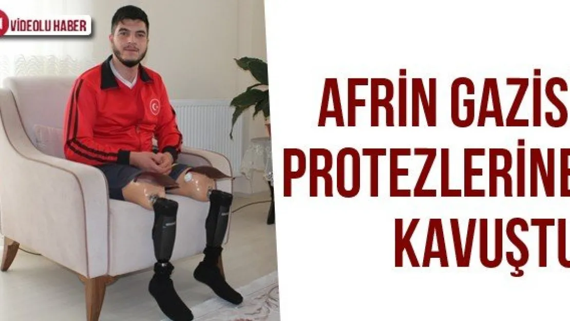 Afrin Gazisi Protezlerine Kavuştu