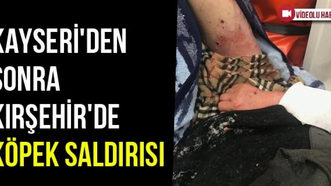 Kayseri'den Sonra Kırşehir'de Köpek Saldırısı
