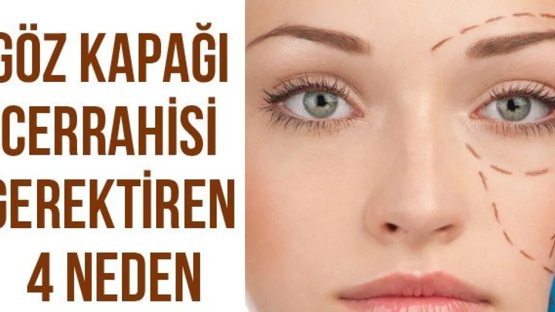 Göz kapağı cerrahisi gerektiren 4 neden