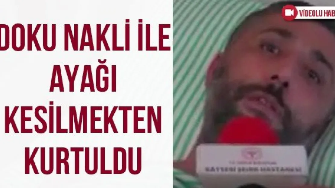 Doku Nakli İle Ayağı Kesilmekten Kurtuldu