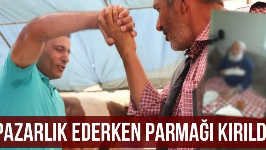 Pazarlık ederken parmağı kırıldı