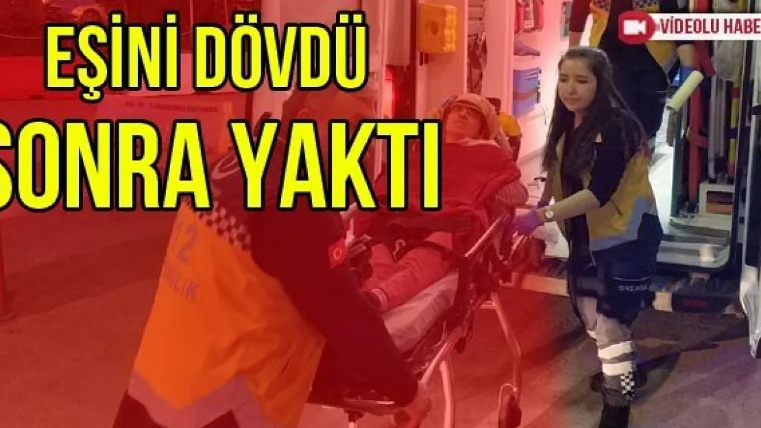 EŞİNİ DÖVDÜ SONRA YAKTI