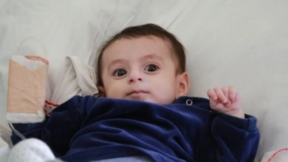 5 Aylık Bebeğin Kalbindeki Doğuştan İki Delik Cerrahisiz Yöntemle Kapatıldı 