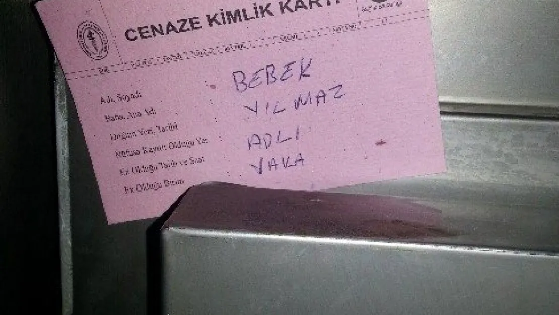 Doğum Yaparken Bebeğinin Bacağını Kesti 