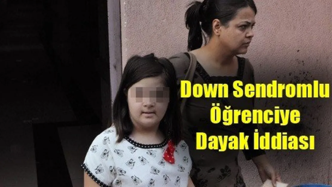 Down Sendromlu Öğrenciye Dayak İddiası