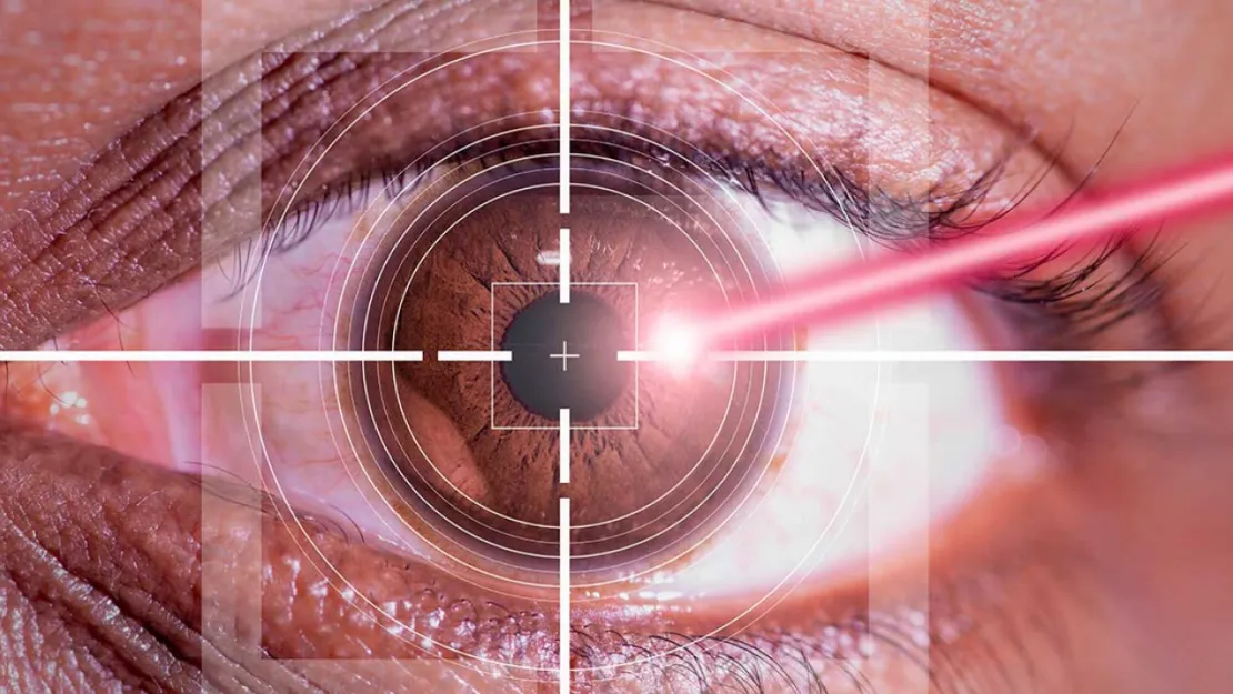 Lazer tedavisinden sonra görme netliği ne zaman kazanılır?