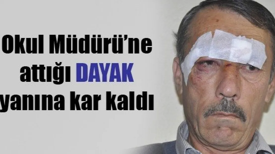 Müdürün Kaşına 5 Dikiş Atıldı