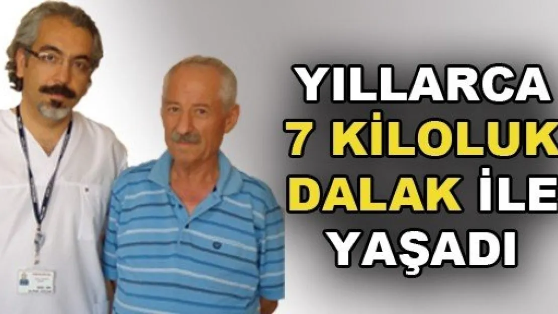 Yedi Kiloluk Dalakla Yıllarca Yaşadı