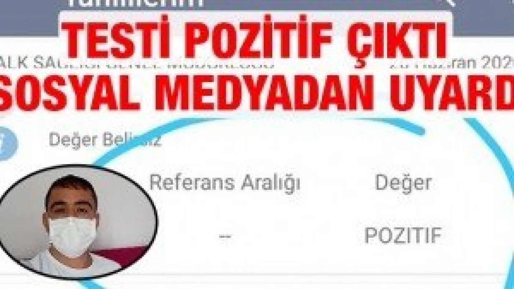 Testi pozitif çıktı sosyal medyadan uyardı