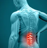 Bel fıtığı hastalarına 9 öneri