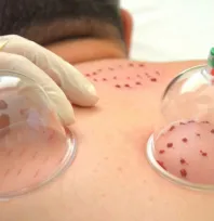 Doktor Kılınç, 'Hacamatın özel günü yok!'