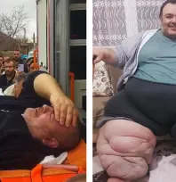 Engin Akbadal'ın Fil Hastalığı İçin Ankara'ya Sevk Edilmesi