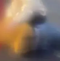 Otomobilin çarptığı 18 yaşındaki genç ağır yaralandı