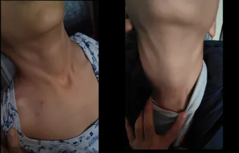 9 yaşındaki öğrenciden sınıf öğretmeni hakkında darp iddiası