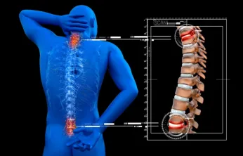 Omurga kırığında yeni nesil tedavi nasıl uygulanır?