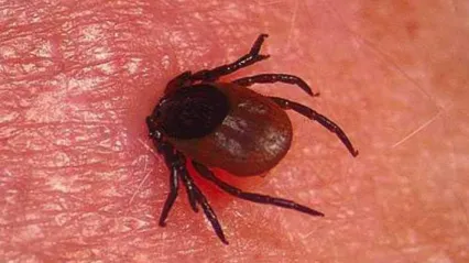 Vücudumuza kene yapışırsa ne yapmalıyız?