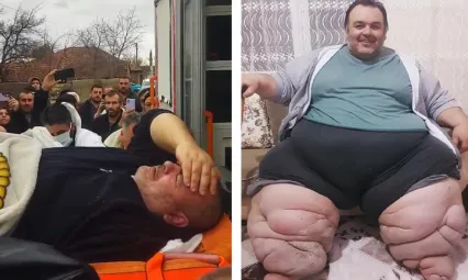 Engin Akbadal'ın Fil Hastalığı İçin Ankara'ya Sevk Edilmesi