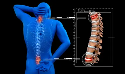Omurga kırığında yeni nesil tedavi nasıl uygulanır?