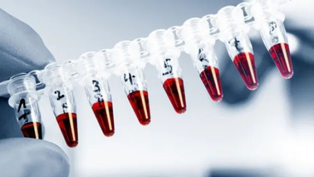 Sığırın kalp zarında kök hücre bulundu