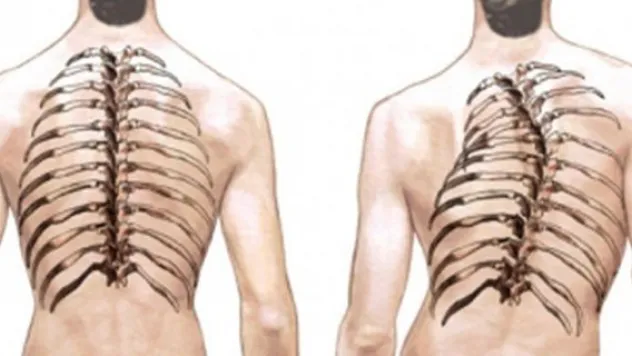 Asimetrik hastalığa dikkat!