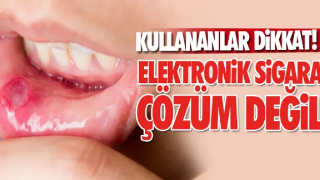 Elektronik sigara çözüm değil!