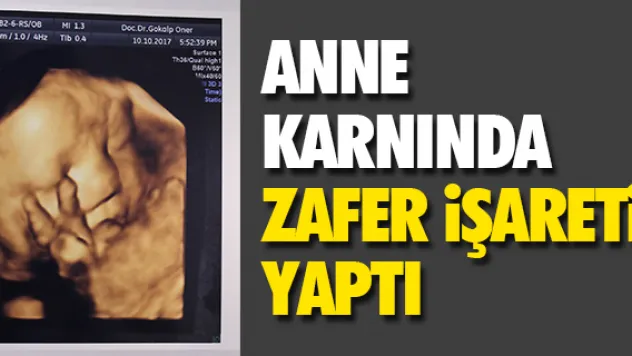 ANNE KARNINDA ZAFER iŞARETi YAPTI