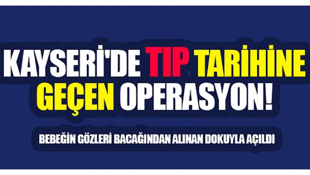 Bebeğin gözleri bacağından alınan dokuyla açıldı