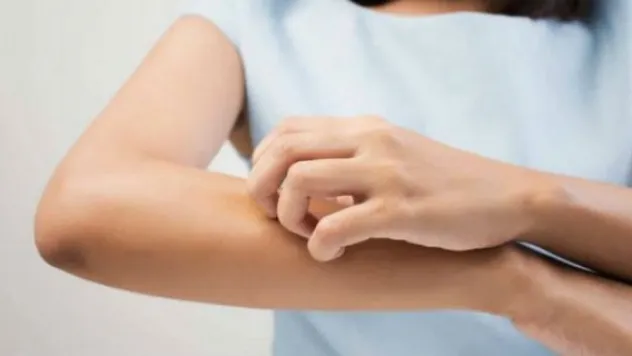 Egzamadan korunmak için bol bol su için