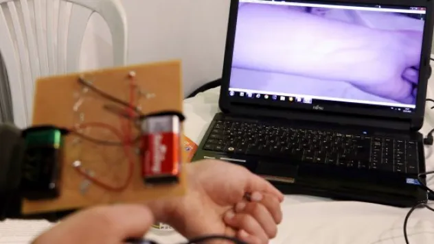 Kanser hastası arkadaşları için proje geliştirdiler