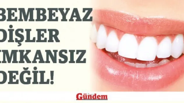 Bembeyaz Dişler İmkansız Değil!