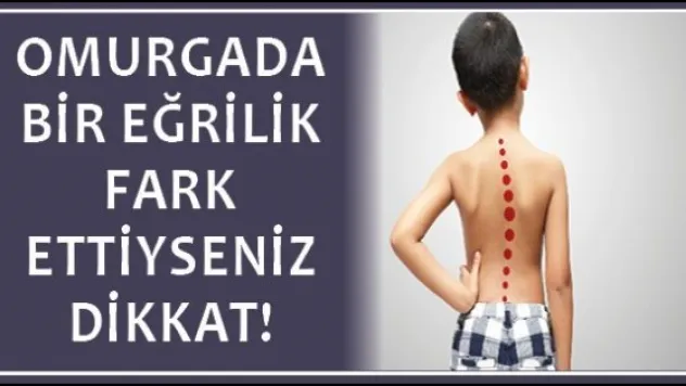 OMURGADA BİR EĞRİLİK FARK ETTİYSENİZ DİKKAT!
