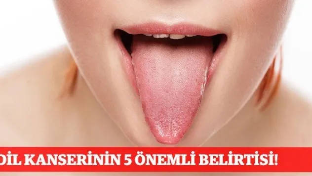 Dil Kanserinin 5 Önemli Belirtisi!