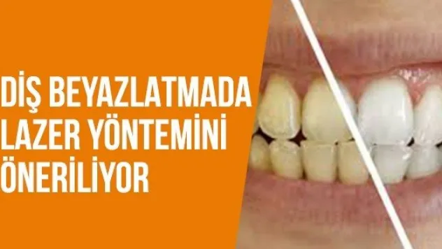 Diş beyazlatmada lazer yöntemini öneriliyor