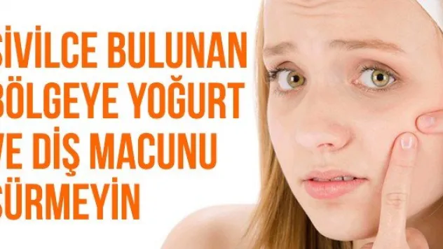 Sivilce Bulunan Bölgeye Yoğurt Ve Diş Macunu Sürmeyin