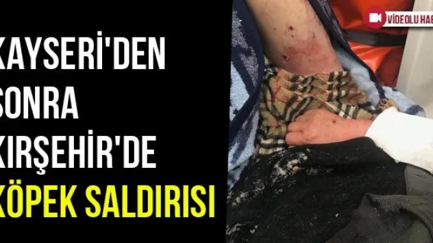 Kayseri'den Sonra Kırşehir'de Köpek Saldırısı