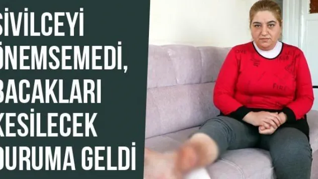 Sivilceyi Önemsemedi, Bacakları Kesilecek Duruma Geldi