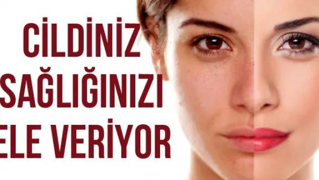 Cildiniz Sağlığınızı Ele Veriyor